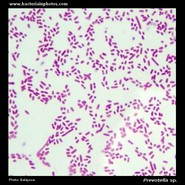 prevotella under microscope